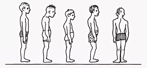 Violation of posture