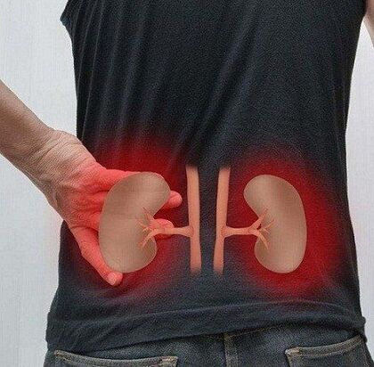 Pyelonephritis may cause low pain