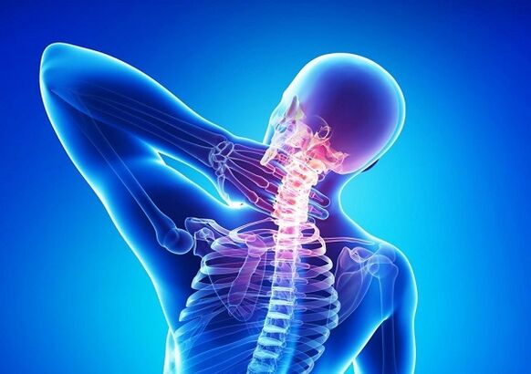 Cervical pain and bone chondrosis