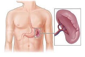 Spleen Pathology Causes Pain Below Left Shoulder Blade