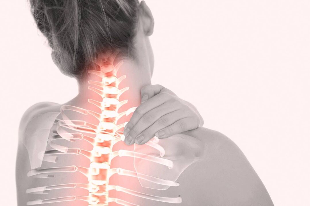 Cervical pain caused by osteochondrosis