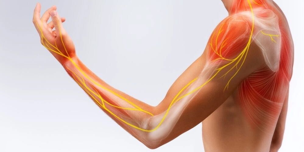 Finger pain and numbness indicate ligament damage due to stenosingitis